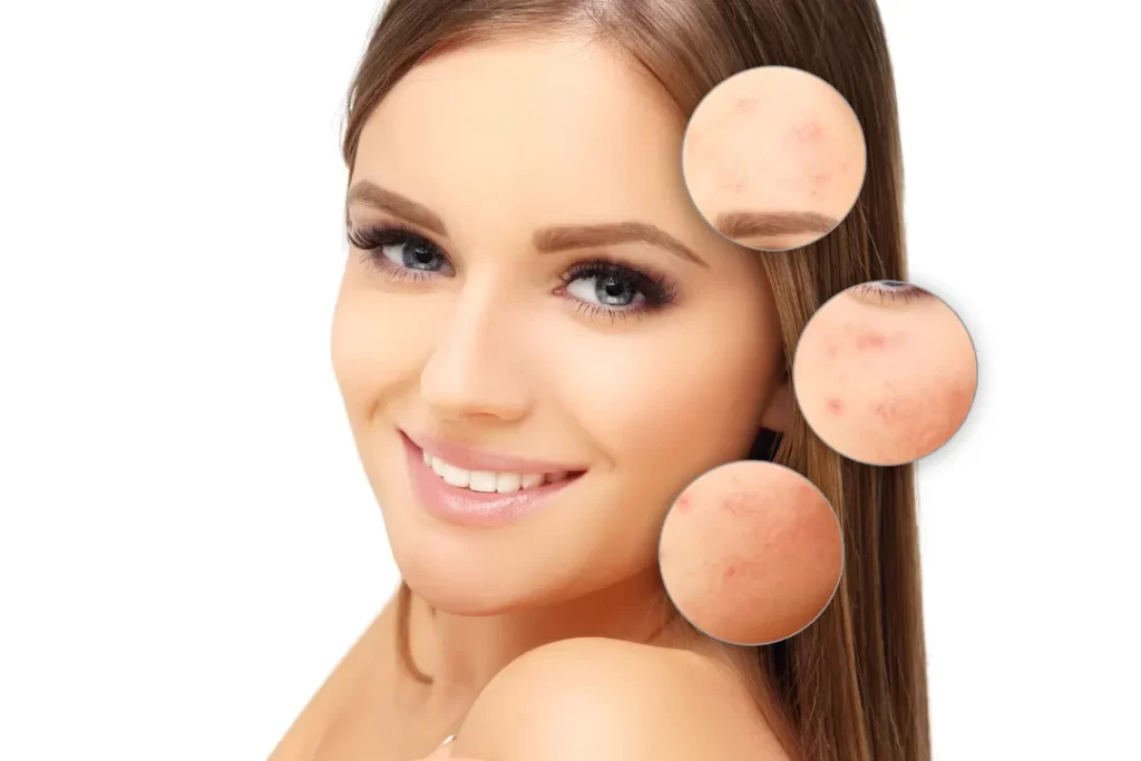 the young girl with clean and attractive skin.