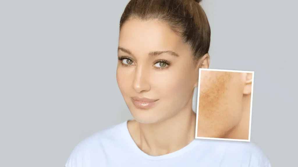 Healthy complexion.