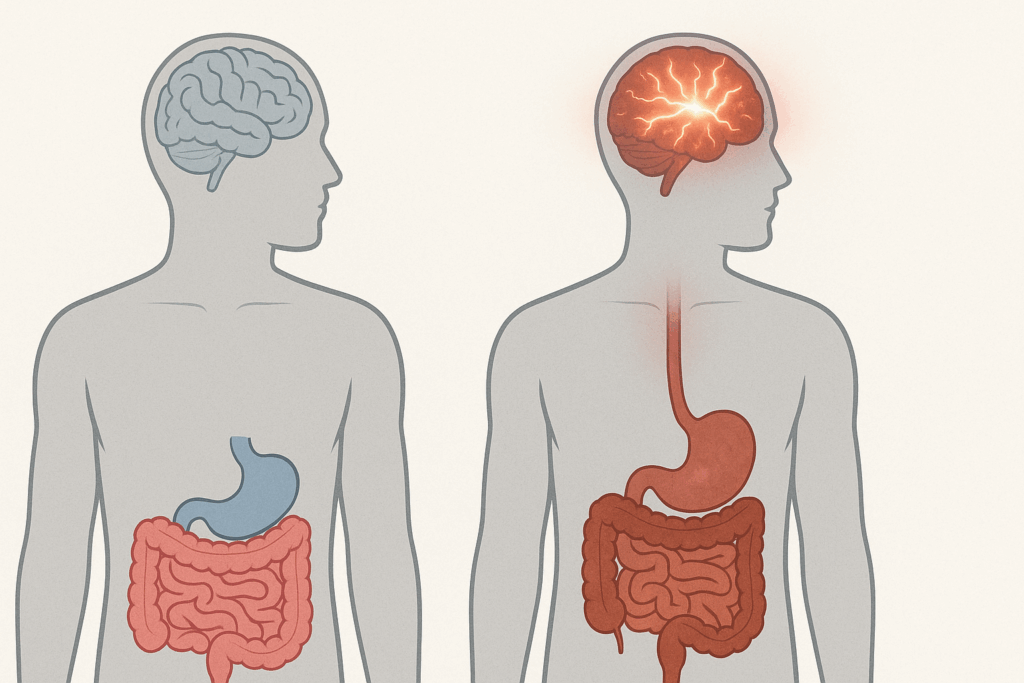 Side-by-side medical illustration comparing a healthy gut with calm brain activity and a leaky gut with stressed brain signals, visualizing how can leaky gut cause anxiety.