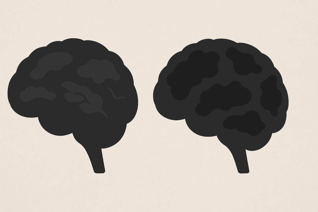 Side-by-side comparison of two brain silhouettes showing progressive cognitive decline, highlighting v differences between mild cognitive impairment and dementia.