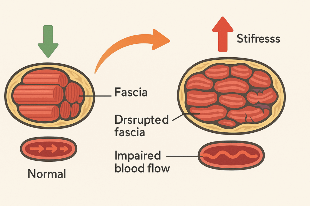 Diagram showing how to release chronically tight muscles by contrasting relaxed muscle fibers with stiff, compressed tissue, disrupted fascia, and reduced blood flow